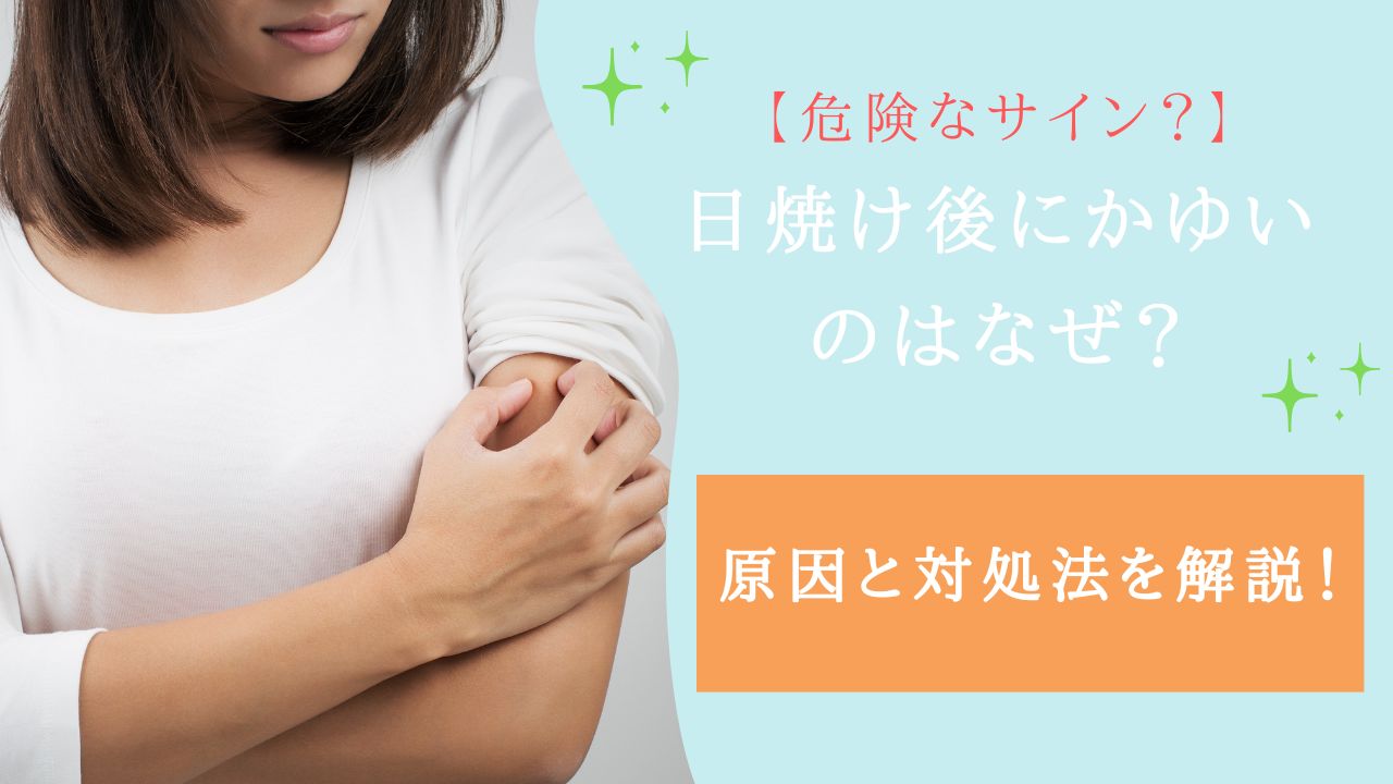日焼け後 かゆい なぜ