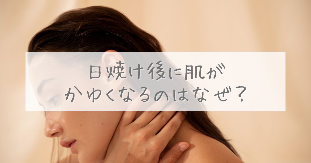 日焼け後 かゆい なぜ