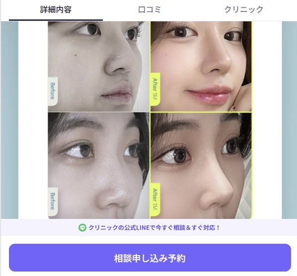 バビトーク 使い方/バビトーク 相談予約方法