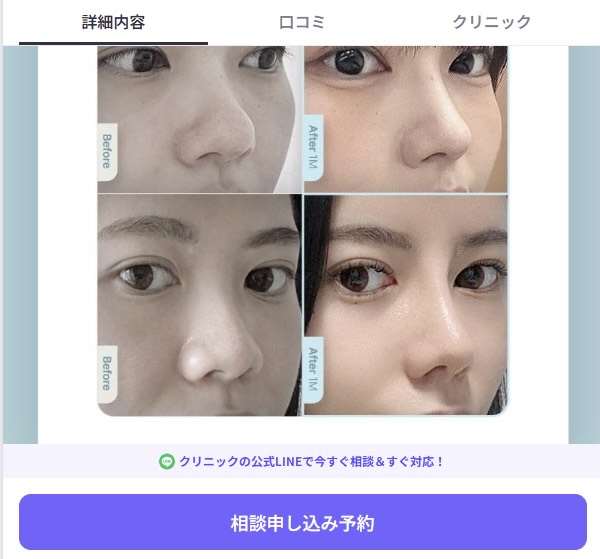 バビトーク 使い方/バビトーク 相談予約方法
