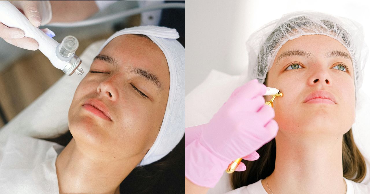 韓国 糸リフト 失敗,韓国 糸リフト 種類,韓国 糸リフト 効果