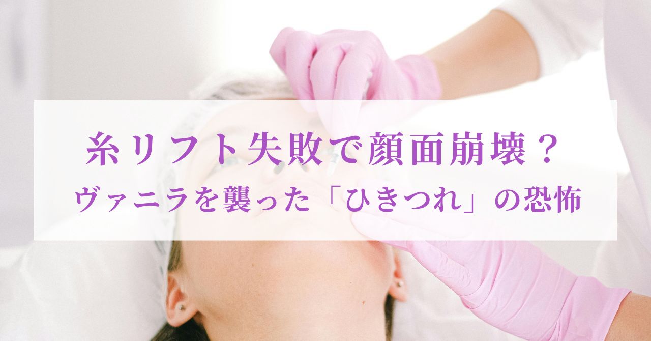 糸リフト 失敗 芸能人